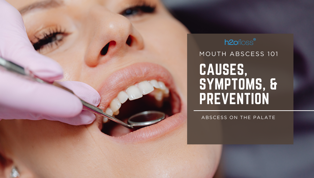 Abscess on the Roof of the Mouth: Causes, Symptoms, and Prevention