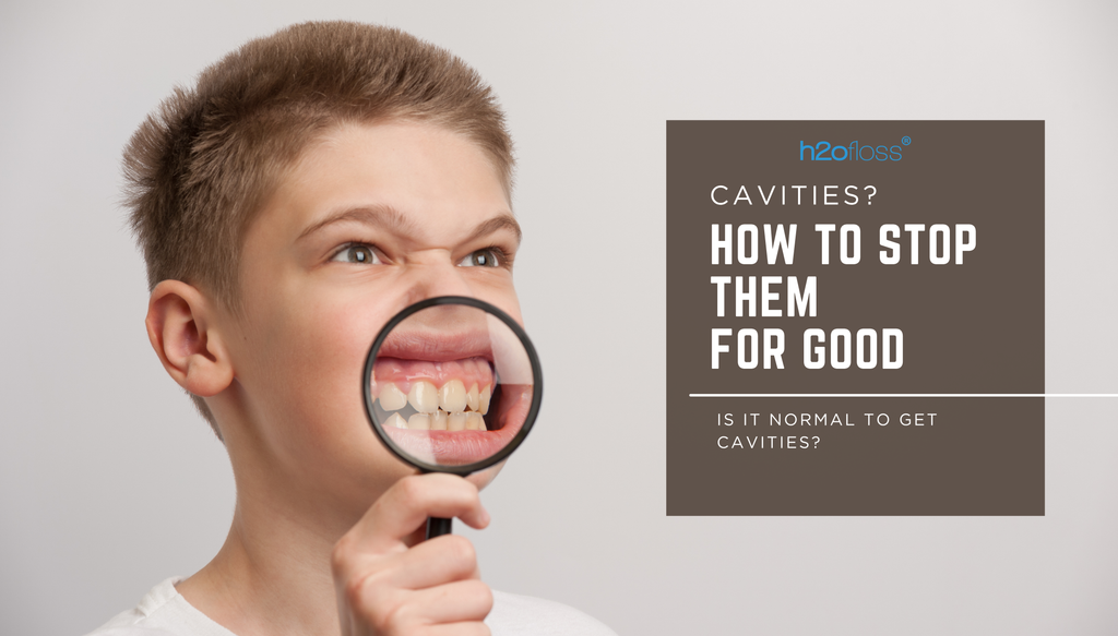 Why Do I Have So Many Cavities? Understanding Cavities and How to Prevent Them